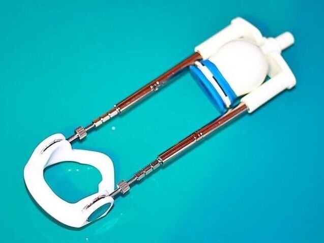 Fallose pikendamiseks võite kasutada spetsiaalset seadet - pikendajat.